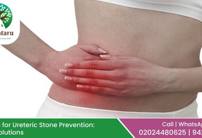 Ayurveda for Ureteric Stone Prevention: Holistic Solutions