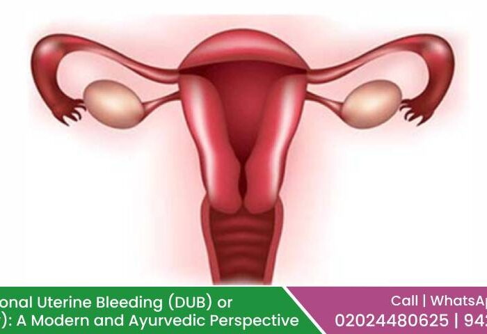 Dysfunctional Uterine Bleeding (DUB) or (Atyartav): A Modern and Ayurvedic Perspective